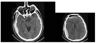 核磁管使用時的注意事項