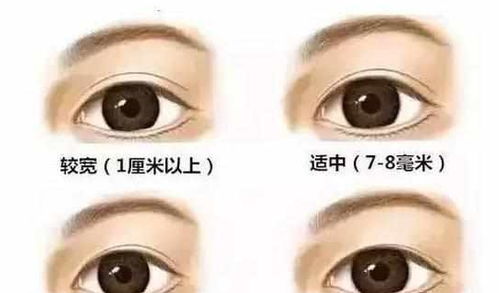 割雙眼皮睡覺注意事項(xiàng)