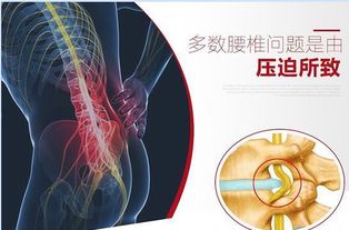 腰椎突出注意事項