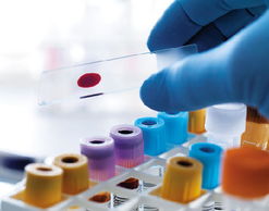 孕婦,注意事項,測試