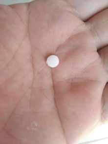 蕁麻疹,小兒,注意事項