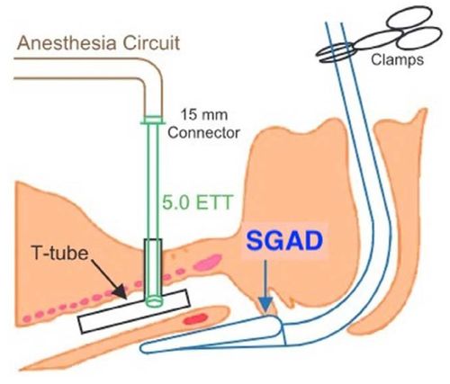 量氣裝置使用注意事項,氣管封堵管使用注意事項,量檢具使用注意事項