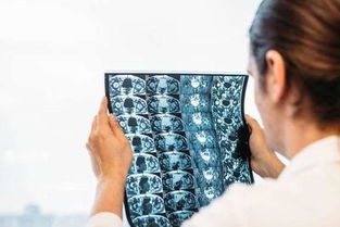 血腫,腦部,注意事項,飲食