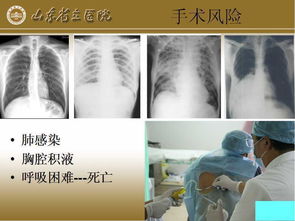 纖維瘤術(shù)后注意事項(xiàng),肩胛骨纖維瘤注意事項(xiàng),纖維瘤切除術(shù)后注意事項(xiàng)