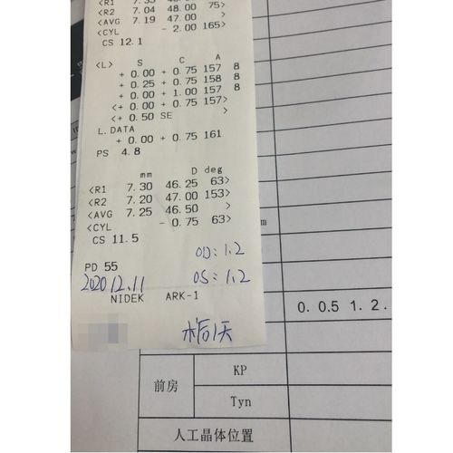 眼睛做完icl手術(shù)后注意事項(xiàng),icl手術(shù)后飲食注意事項(xiàng),做完宮腔鏡手術(shù)后注意事項(xiàng)