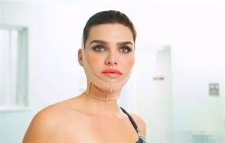 臉部光釬溶脂后注意事項(xiàng)