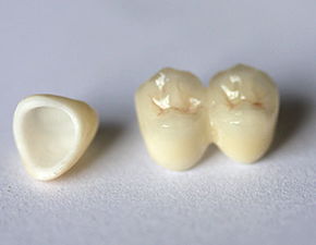 戴牙冠后注意事項(xiàng),做了臨時(shí)牙冠注意事項(xiàng),裝牙冠后注意事項(xiàng)