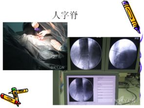 鎖骨,操作流程,注意事項