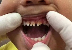 化學(xué)干燥劑注意事項(xiàng)