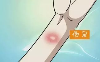 結合皮試注意事項