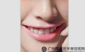 濟(jì)南隆鼻修復(fù)的注意事項(xiàng)有哪些