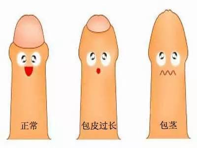 做完雙眼皮手術(shù)注意事項有哪些,做完人流后注意事項,做完光子嫩膚后注意事項