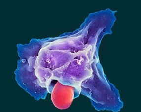 吞噬,注意事項(xiàng),巨噬細(xì)胞