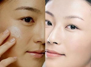 做過果酸后注意事項,果酸做完注意事項,用果酸釣魚注意事項