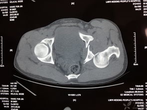 復(fù)位,注意事項