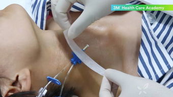 cvc管護(hù)理及注意事項ppt,cvc置管的護(hù)理及注意事項,cvc的護(hù)理與注意事項