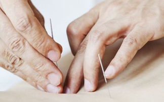 針灸,注意事項(xiàng),治療