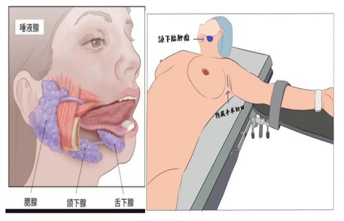 查甲狀腺掛什么科注意事項(xiàng)