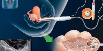取盡頭牙后注意事項(xiàng)
