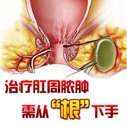 手術治療,注意事項