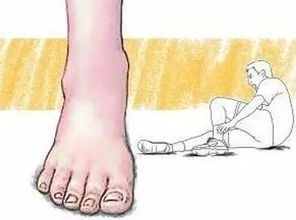 手拉扭傷注意事項(xiàng)