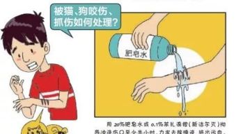 打了狂犬疫苗的注意事項(xiàng)