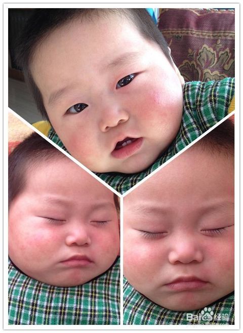 風(fēng)疹,注意事項,幼兒