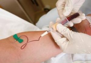 采血,靜脈,注意事項(xiàng),技術(shù)