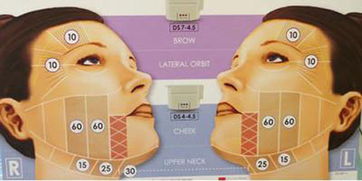 超聲刀操作注意事項(xiàng)