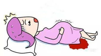 引產(chǎn)后注意事項(xiàng)有哪些