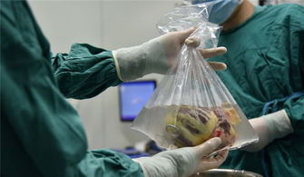 換心,術后,注意事項,手術