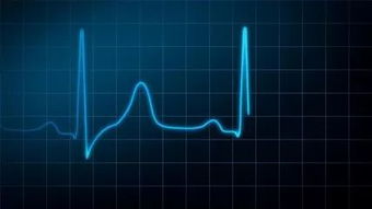 動態(tài)心電圖注意事項,心電圖的操作流程及注意事項,做心電圖注意事項