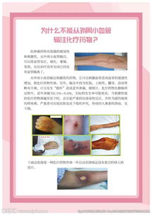 阿托品的輸液注意事項(xiàng)