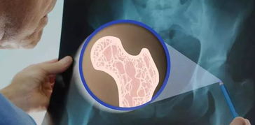 密固達(dá)使用后注意事項(xiàng)