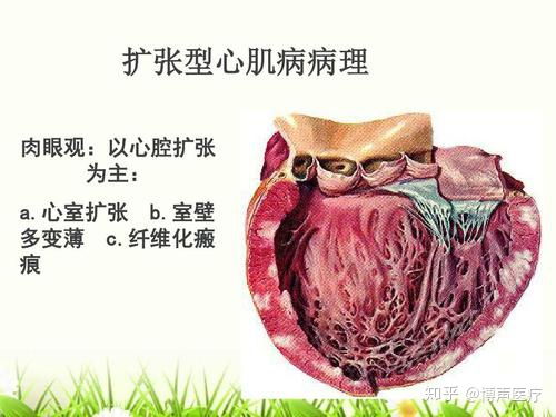 心臟球囊擴(kuò)張術(shù)后注意事項,心臟支架術(shù)后注意事項,心臟支架十大注意事項