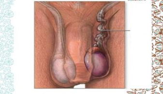 睪丸切除術(shù)前注意事項(xiàng)