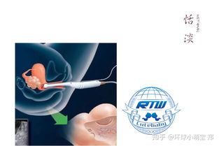 試管嬰兒取卵前后注意事項(xiàng)