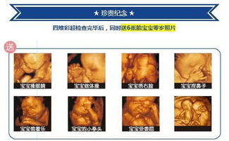 做肝臟彩超的注意事項(xiàng),做彩超的注意事項(xiàng),做彩超檢查注意事項(xiàng)