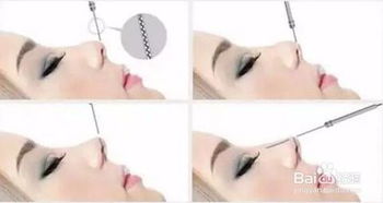 做好線雕鼻子注意事項(xiàng)