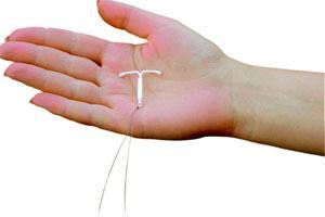 上環(huán)術(shù)前的注意事項(xiàng)有哪些,初次上環(huán)的女性需要注意事項(xiàng),女性上環(huán)的最佳時間及注意事項(xiàng)