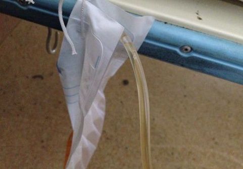 老人插尿管注意事項