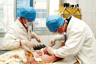 燒傷暴露療法注意事項(xiàng)