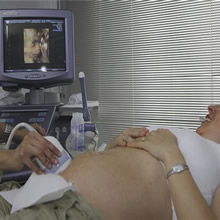 女人備孕注意事項(xiàng),孕檢b超注意事項(xiàng),孕6周b超注意事項(xiàng)