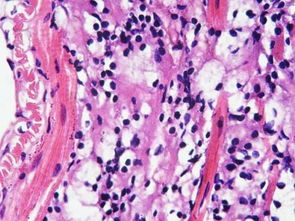 抗酸染色注意事項(xiàng),芽孢染色注意事項(xiàng),石蠟切片染色注意事項(xiàng)