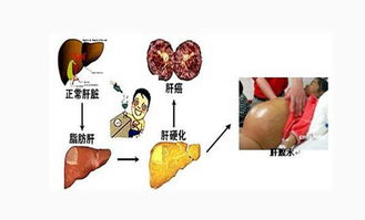 護(hù)理梅毒患者注意事項,梅毒患者日常生活注意事項,梅毒患者平時注意事項