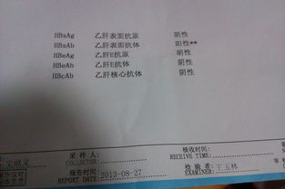 谷丙轉(zhuǎn)氨酶偏高注意事項