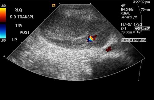 注意事項(xiàng),護(hù)理,動(dòng)靜脈