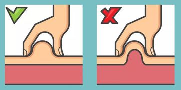 胰島素注射的目的及注意事項,胰島素腹部注射范圍以及注意事項,糖尿病患者注射胰島素的注意事項