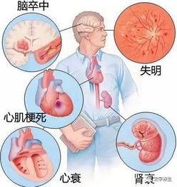 心臟病輸液注意事項(xiàng),心臟病患者輸液注意事項(xiàng),輸液五大注意事項(xiàng)