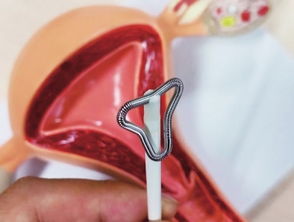 摘掉,注意事項,節(jié)育環(huán)